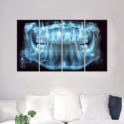 Printed Canvas Artwork: X-Ray Jaw Design for Dental Office Decor,4P Wrapped Canvas