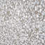 Terrazzo 9" Hexagon Matte Terrazzo Look Porcelain Tile-7082768