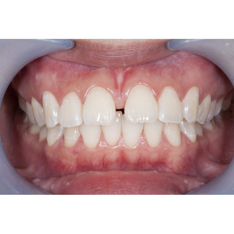 Diastema by Watanyou - Wrapped Canvas Print, 51cm H x 76cm W