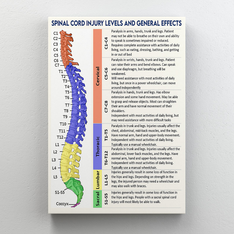 «Spinal Cord ANALYSE - Niveaux de blessures de la moelle épinière et effets généraux», reproduction d'art graphique sur toile tendue