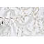 Lesli - Lustre à plusieurs niveaux de style bougie-113607365-26991666