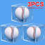 Baseball Display Case