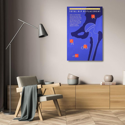 «Total Hip remplacement» par National Institute of Health - Art mural sur toile tendue avec châssis