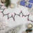 100-Count Mini Christmas Light Set 20.25ft Wire-694996664