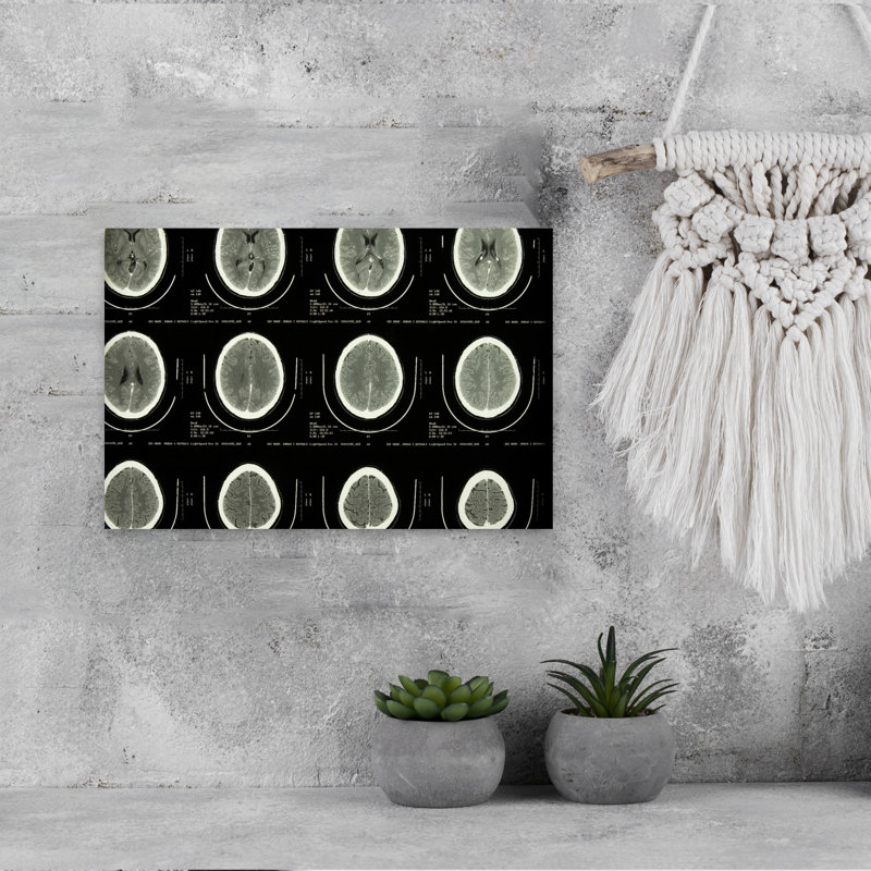 «Mri Brain Scans Abstract Contemporary Portrait Architecture», art mural, H 12 po x l 18 po