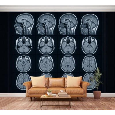 Wall Mural Peel and Stick Wallpaper scan brain Medicine Health Self-Adhesive Removable Contact Paper Wall Decor for Living Room Bedroom 100"H x 144"W