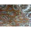 Mountain King One-of-a-Kind 6' X 9' Area Rug