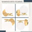 Wall Light 1 Flame E27 Globe Design Marhta-1250072245
