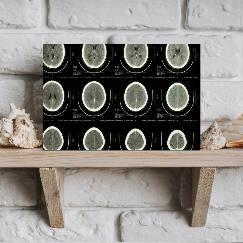 «Mri Brain Scans Abstract Contemporary Portrait Architecture», art mural, H 12 po x l 18 po
