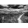 Nantucket Pathway by Aledanda - No Frame Print on Canvas