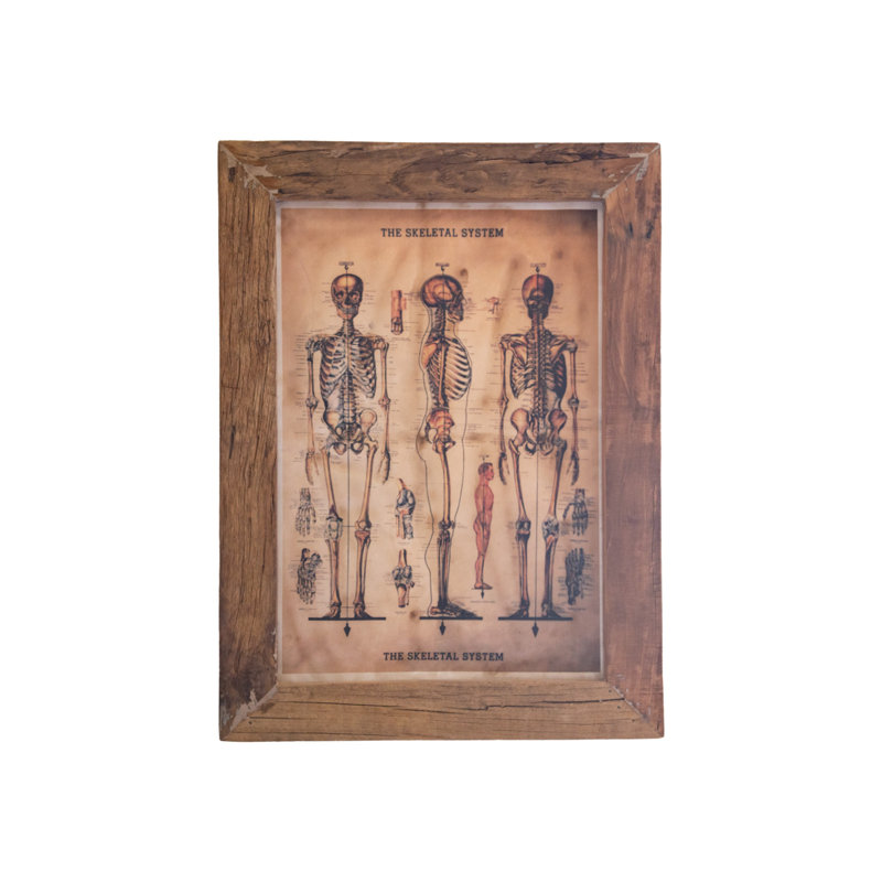 Skeleton - Picture Frame Print on Wood