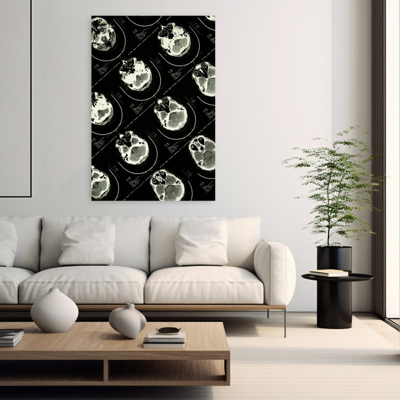 MRI Brain Scans by Bob Masters - Wrapped Canvas Print, 152.4cm H x 101.6cm W