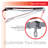 Advaning 10.5'' D Metal Cover Retractable Patio Awning-25056122-25056123