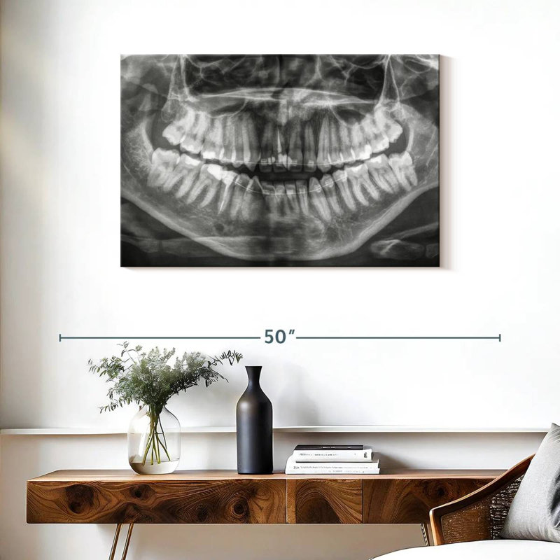 Radiographie Alcaraz, H 24 po x l 36 po
