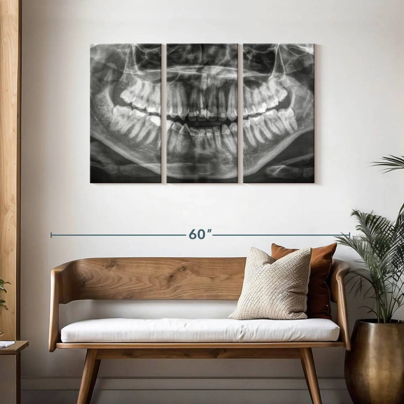 Radiographie Alcaraz, H 28 po x l 45 po