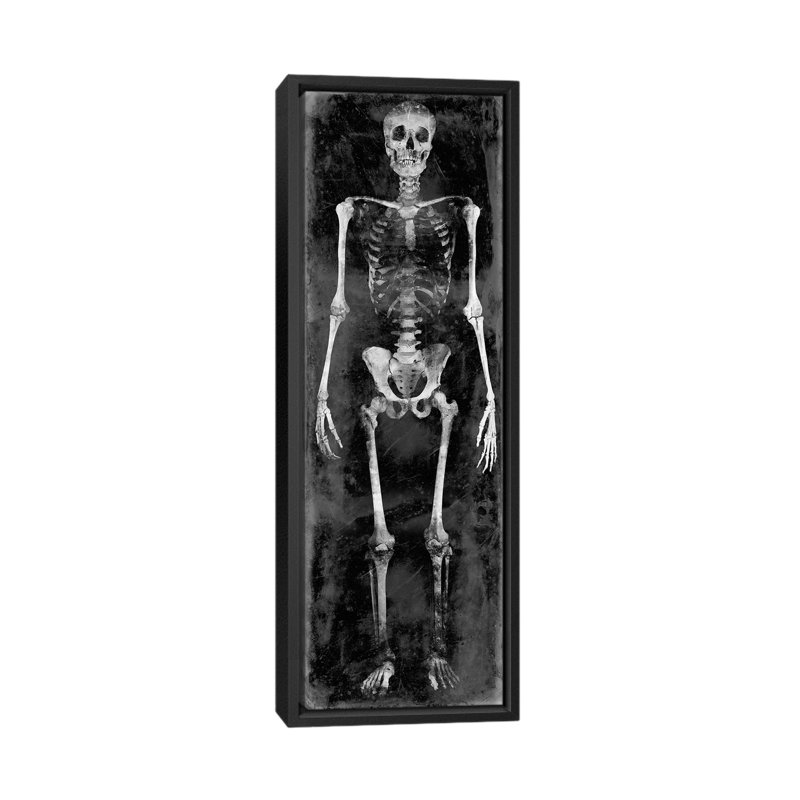 «Skeleton II», impression sur toile, H 36 po x l 12 po x P 1,5 po, Toile avec cadre noir