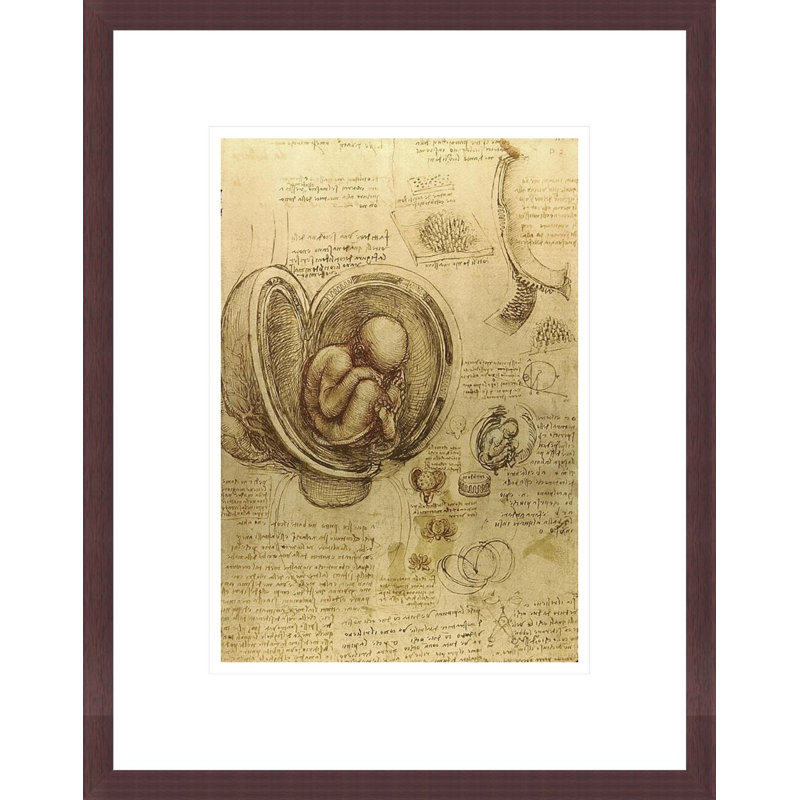 Study of fetus by Leonardo da Vinci -Framed Giclee Print, H 16,75 po x l 13,24 po