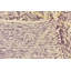 Tapis mauve Nestor