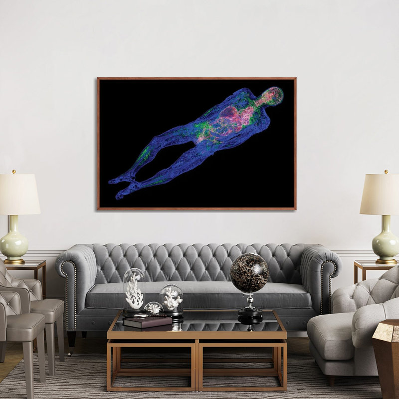 Corps humain, tomodensitométrie - reproduction d'art murale - toile encadrée, 60" x 40", Framed Canvas, Brown