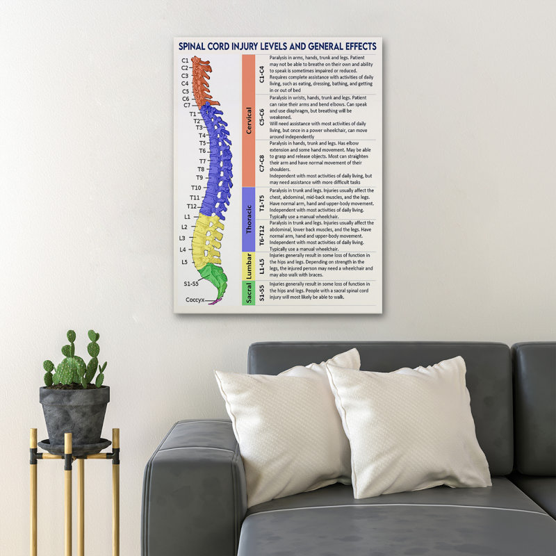 «Spinal Cord ANALYSE - Niveaux de blessures de la moelle épinière et effets généraux», reproduction d'art graphique sur toile tendue