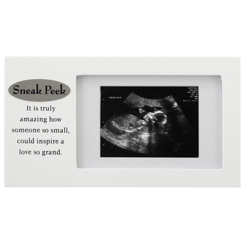 Alfonsino White Single Picture Frame