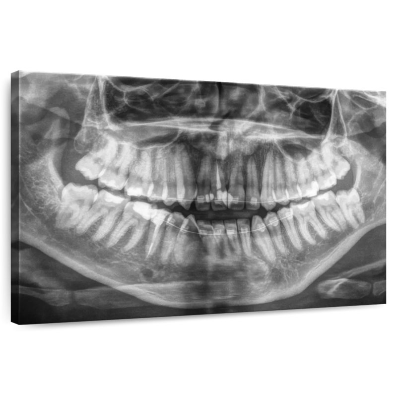 Radiographie Alcaraz, H 24 po x l 36 po