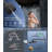 Dual Shower Head With Handheld Spray - High Pressure Rainfall Shower System, 3+1 Spray Modes, Includes 3-Way Diverter & Adjustable Extension Arm-112707517