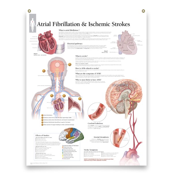 Trinx Jaraya Educational Poster 