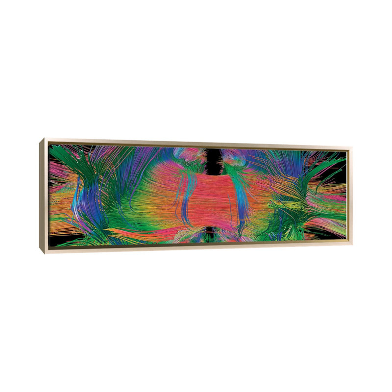 «Brain Fibers Face View, DTI Scan», reproduction d'art mural - toile encadrée, 48" x 16", Framed Canvas, Champagne