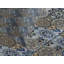 Adilyn Blue/Yellow Microfibre Bedspread Set-663457090