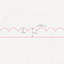 Medium Decorative Scallop Design Trim - 95 x 5cm -Edging MDF Wood (Moisture Resistant) - Dado Moulding for DIY-120081933