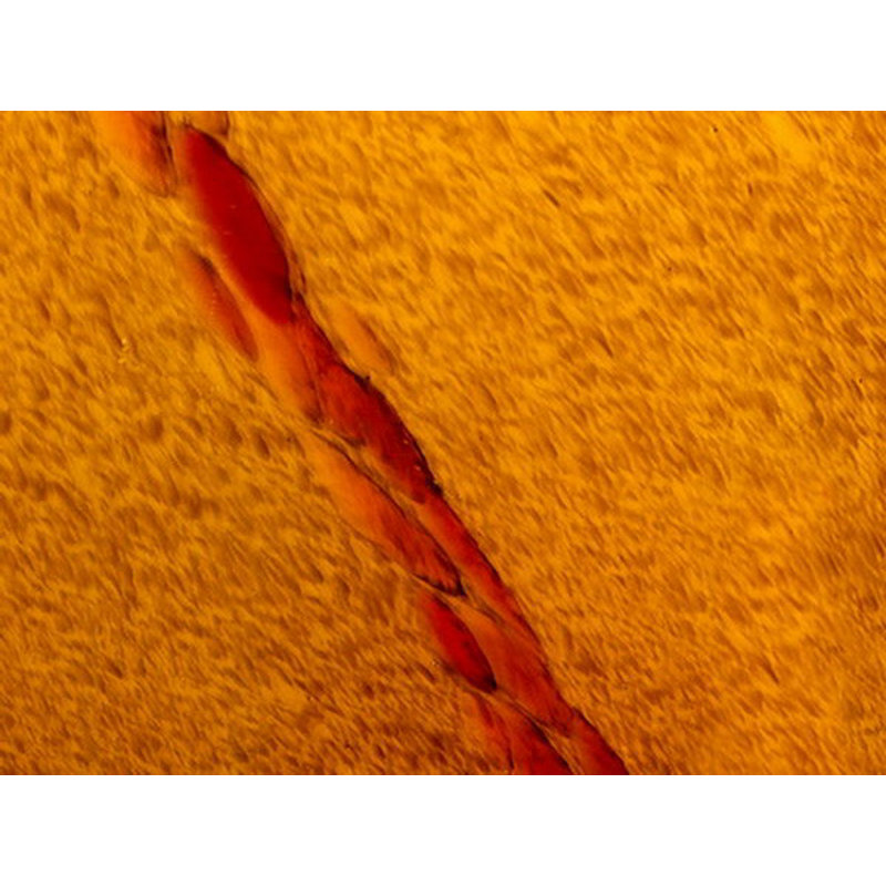 Ensemble de rail d'éclairage 5 lumières Alberto, Acier brossé, Tache ambre