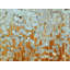 «Speak Life. Proverbes 18:21 ', impression sur toile-17653738-25503759