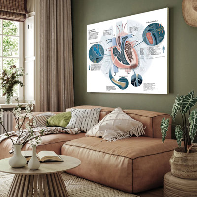Congestive Heart Failure Anatomy Poster