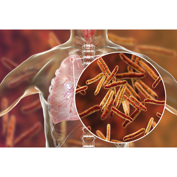 Happy Larry Close-Up View Of Mycobacterium Tuberculosis Bacteria ...