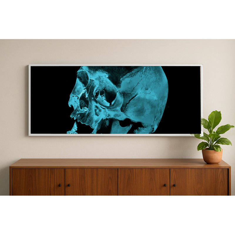 Gibbs X-Ray Photography Print, 11.75" H x 31.75" W, White
