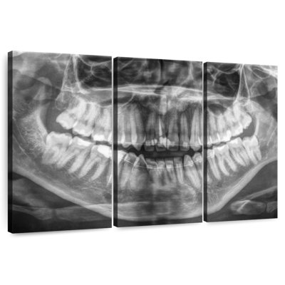 Radiographie Alcaraz