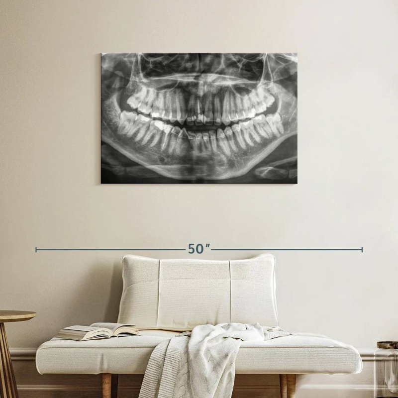 Radiographie Alcaraz, H 24 po x l 36 po