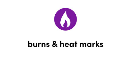 Burns & heat marks