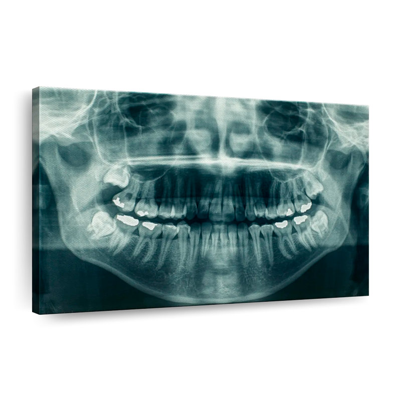 Dental X-Ray View Canvas Print, 30" W x 45" H