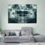 «Dentaire X-Ray View», reproduction sur toile-798224428