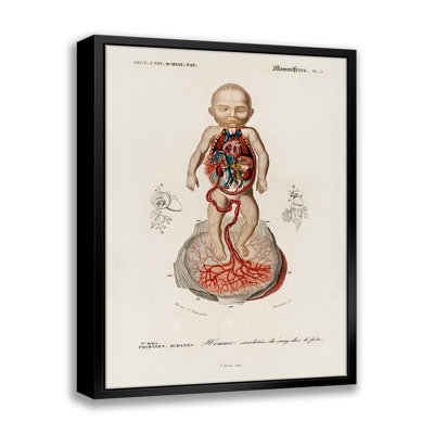 «Circulation Of The Blood In A Fetus», cadre flottant, impression sur toile
