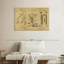 Outils dentaires, impression sur toile-1149966866