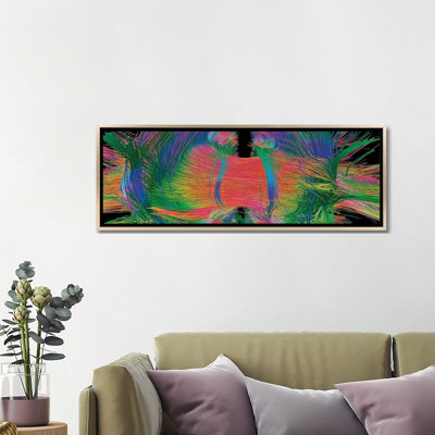 «Brain Fibers Face View, DTI Scan», reproduction d'art mural - toile encadrée