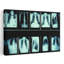 Radiographie de la commode humaine abstraite, art mural contemporain-1639258738